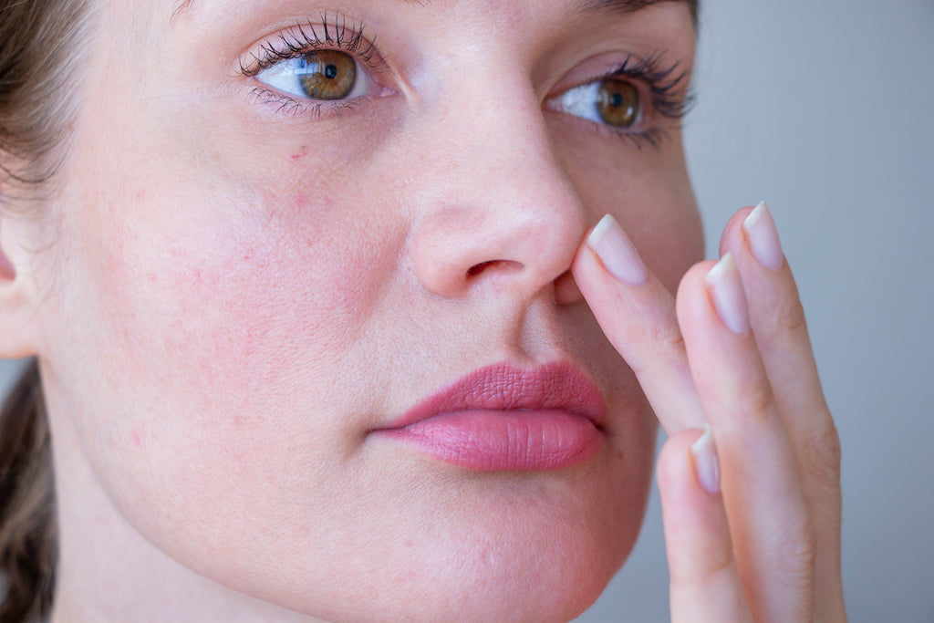 Rosacea Awareness Month: Understanding the Causes, Triggers and Solutions