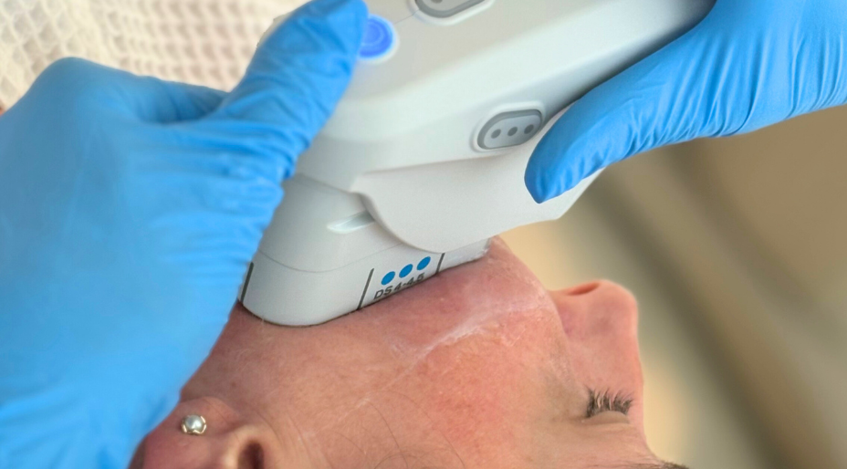 Timeless Skin, No Surgery: Discover Ulthera - The Future of Beauty