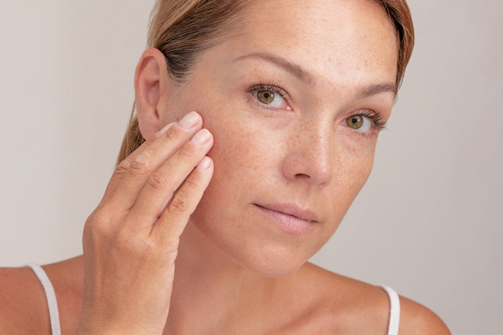 How to Finally Get Rid of Dark Spots