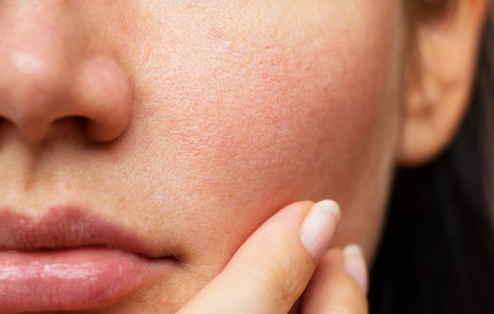 What is Your Skin Barrier and How to Protect It: A Comprehensive Guide to Healthy Skin